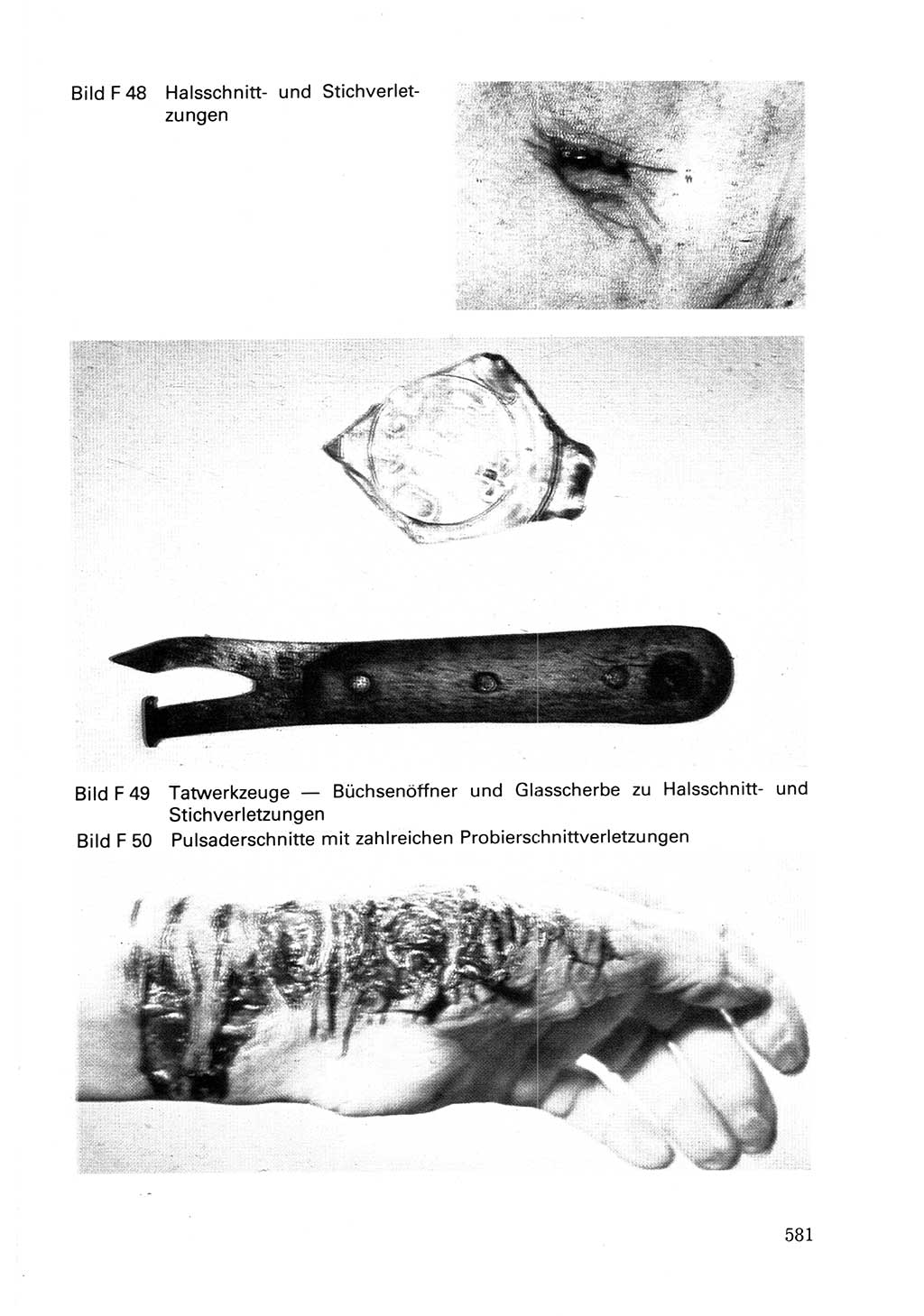 Wörterbuch der sozialistischen Kriminalistik [Deutsche Demokratische Republik (DDR)] 1981, Seite 580 (Wb. soz. Krim. DDR 1981, S. 580)